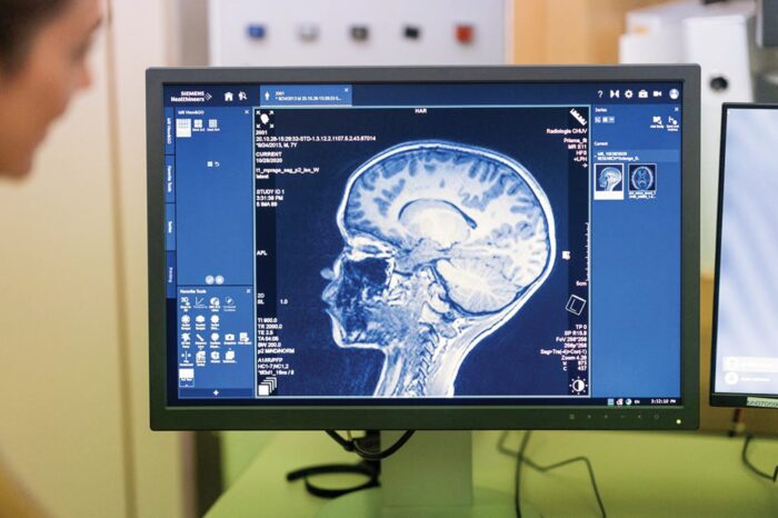 Montessori research on executive function and beyond